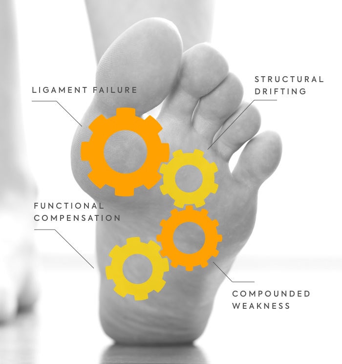 拇指外翻/拇趾外翻/Bunion ligament